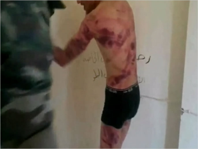 ‪صور بثها معارضون تظهر ممارسة النظام تعذيبا ممنهجا بحق المعتقلين‬ (الجزيرة-أرشيف)