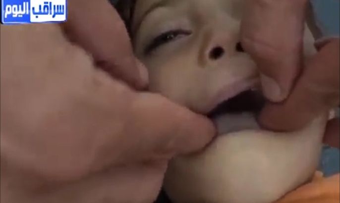 حالات تسمم الأطفال جراء لقاح الحصبة بريف إدلب