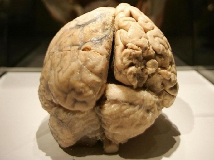 New York, UNITED STATES: A preserved human brain is seen during an advance preview 16 November 2005 for 'Bodies. ..The Exhibition' featuring real humans that will be on display at the South Street Seaport Exhibition Center in New York starting 19 November. The exhibit will showcase 22 whole-body specimens and more than 260 organs and partial body parts that have been perserved using a technique called polymer preservation. The bodies, unclaimed or unidentified individuals from China, were obtained from the Dalian Medical University of Plastination Laboratories who prepare the skinned bodies and body parts via polymer preservation, also called plastination or plasticization, a process through which body water and fats are replaced with liquid silicone rubber. The laboratory supplies the bodies to human-anatomy exhibits around the world.