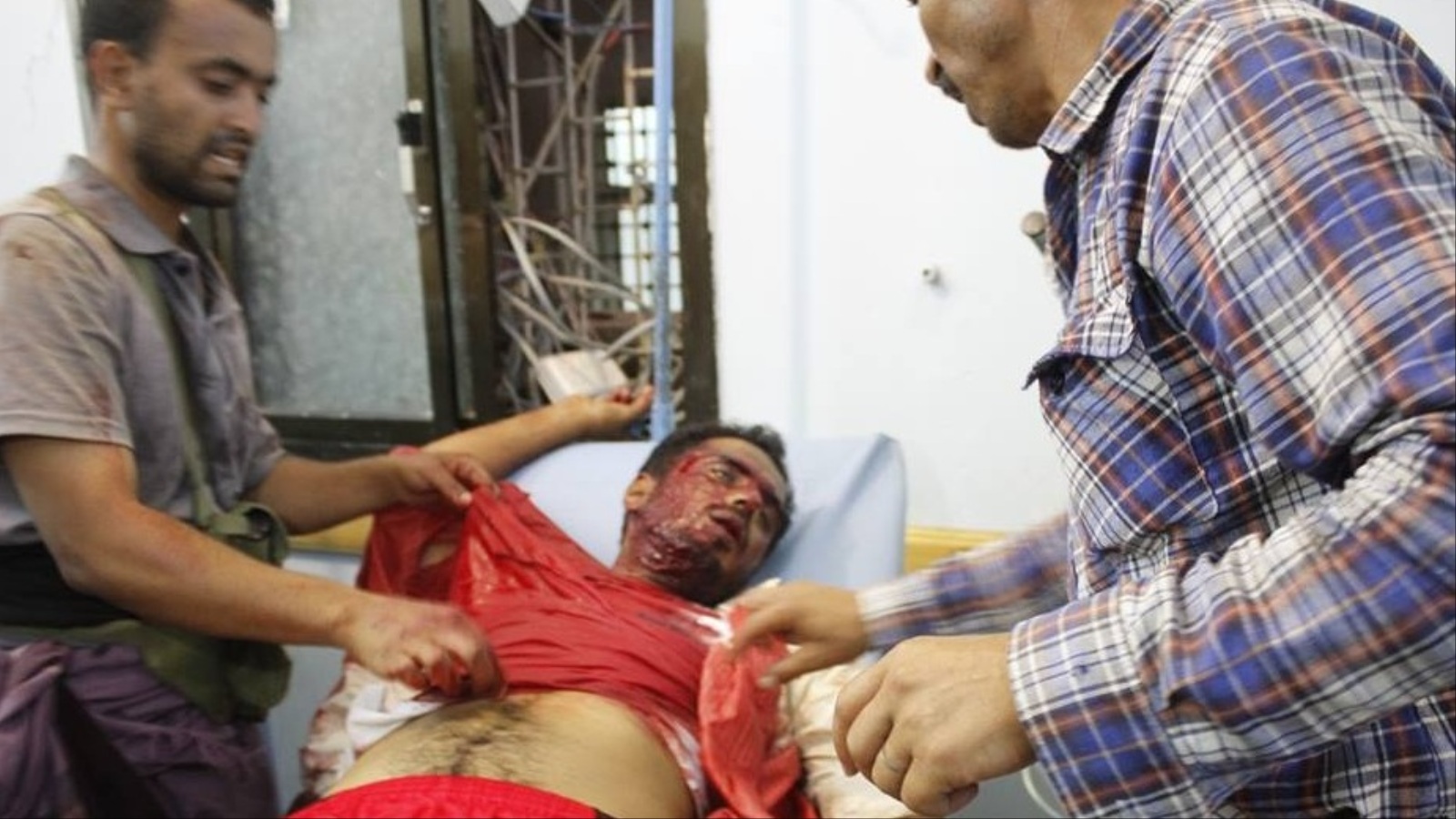 أحد الجرحى المدنيين جراء قصف الحوثيين وقوات صالح على تعز(الجزيرة)