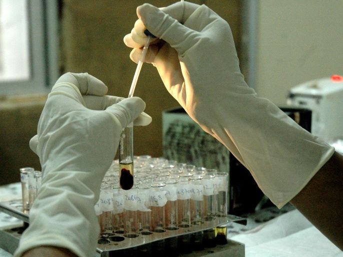 An Indian laboratory technician tests blood samples for HIV as part of a programe of Prevention of Mother To Child Transmission (PMTCT) at a Government Hospital in Hyderabad, 30 November 2006, on the eve of World AIDS Day. World AIDS Day falls 01 December. n the 25 years since the first case was reported, AIDS has killed 25 million people, and infected 40 million more, the United Nations reports that somebody in the world is newly infected with HIV every 8 seconds.