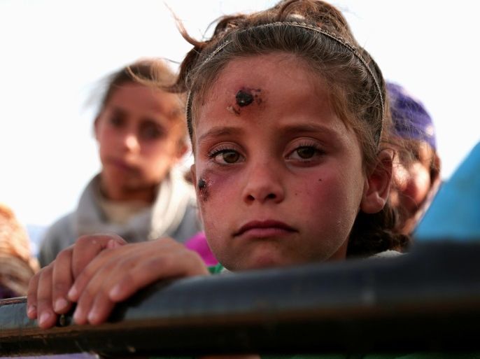 A girl, who according to her parents is showing symptoms of Leishmaniasis, returns with others to their town of Hisha, after the Syrian Democratic Forces (SDF) took control of the area from Islamic State militants, in the northern Raqqa countryside, Syria November 14, 2016. REUTERS/Rodi Said