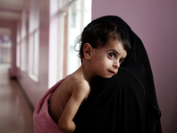 A woman holds her malnourished boy after he was weighed at a hospital malnutrition intensive care unit in Sanaa, Yemen September 27, 2016. REUTERS/Khaled Abdullah TPX IMAGES OF THE DAY SEARCH