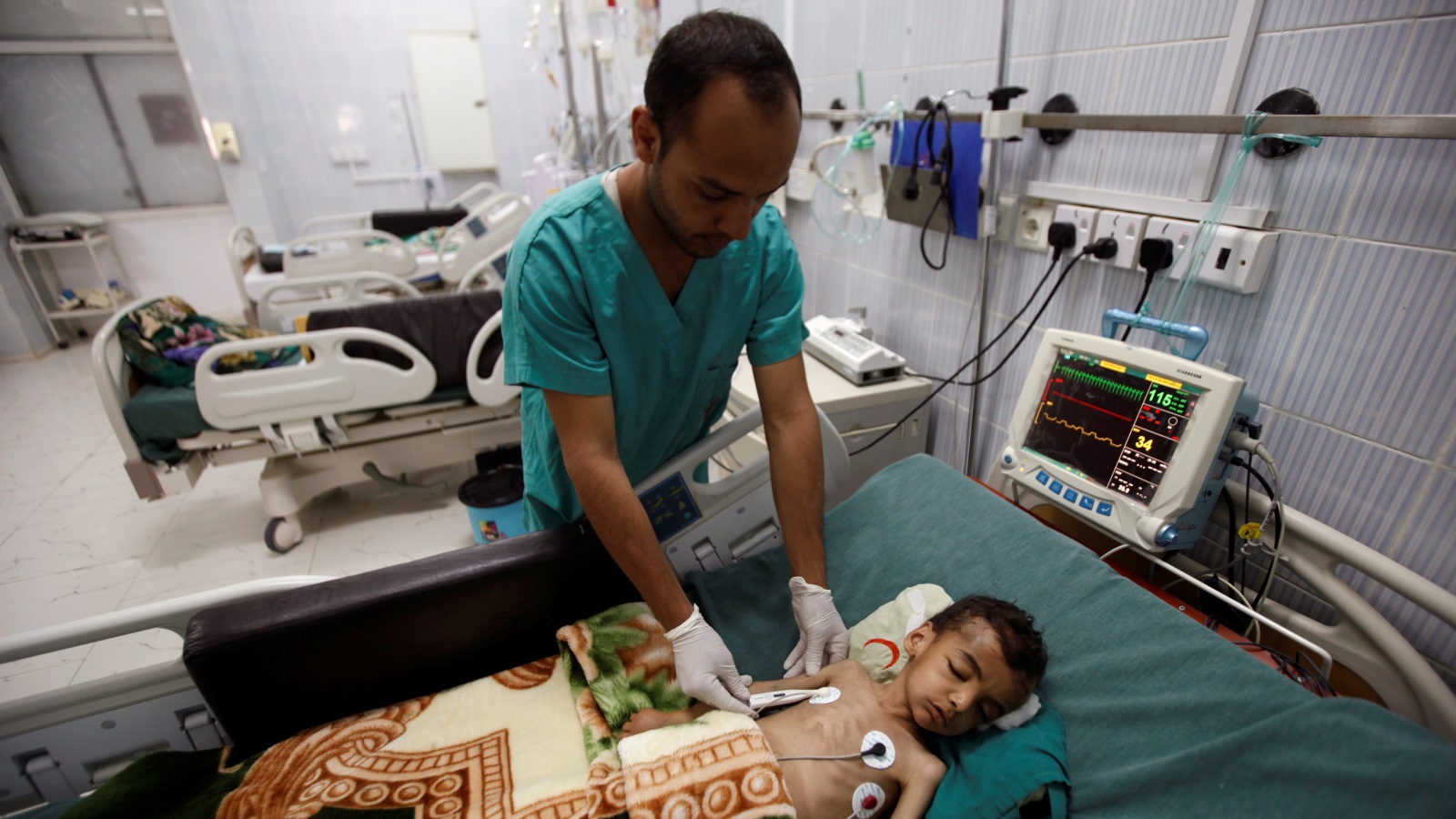 ‪طبيب بمستشفى في صنعاء يفحص طفلا تبدو عليه علامات سوء التغذية‬ (رويترز)