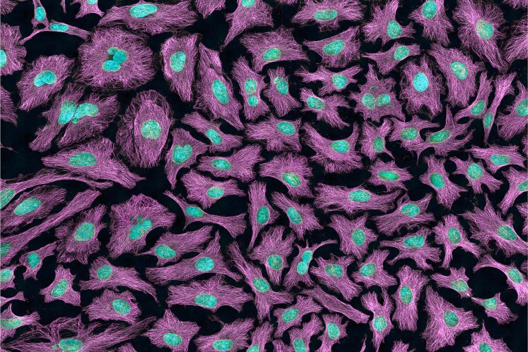 Multiphoton fluorescence image of HeLa cells with cytoskeletal microtubules (magenta) and DNA (cyan). Nikon RTS2000MP custom laser scanning microscope المصدر:national institute of health
